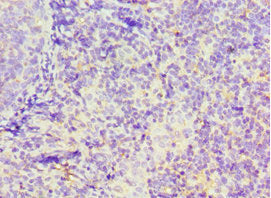 Immunohistochemistry of paraffin-embedded human tonsil tissue using GBP1 Antibody at dilution of 1:100Rabbit anti-Human GBP1 Polyclonal Antibody