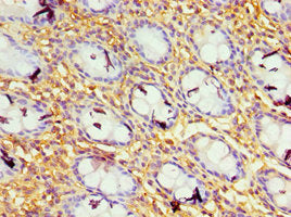 Immunohistochemistry of paraffin-embedded human colon tissue using GBP1 Antibody at dilution of 1:100Rabbit anti-Human GBP1 Polyclonal Antibody