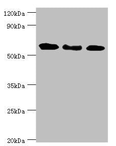 Western blot | All lanes: Interferon-induced guanylate-binding protein 1 antibody at 4μg/ml | Lane 1: MM231 whole cell lysate | Lane 2: Hela whole cell lysate | Lane 3: MGF-7 whole cell lysate | Secondary | Goat polyclonal to rabbit IgG at 1/10000 dilution | Predicted band size: 68 kDa | Observed band size: 68 kDaRabbit anti-Human GBP1 Polyclonal Antibody