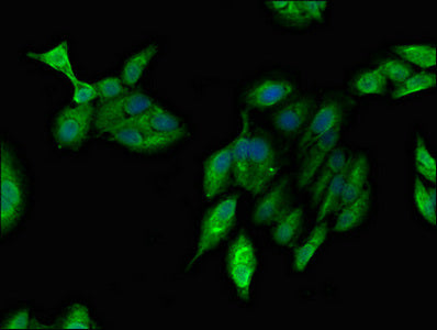 Immunofluorescent analysis of Hela cells using ARF1 Antibody at dilution of 1:100 and Alexa Fluor 488-congugated AffiniPure Goat Anti-Rabbit IgG(H+L)Rabbit anti-Human ARF1 Polyclonal Antibody