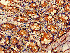 Immunohistochemistry of paraffin-embedded human small intestine tissue using the antibody at dilution of 1:100Rabbit anti-Human ARF1 Polyclonal Antibody