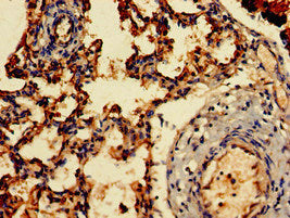 Immunohistochemistry of paraffin-embedded human lung tissue using ARF1 Antibody at dilution of 1:100Rabbit anti-Human ARF1 Polyclonal Antibody