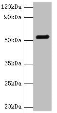 Western blot | All lanes: GC antibody at 2μg/ml + Mouse liver tissue | Secondary | Goat polyclonal to rabbit IgG at 1/10000 dilution | Predicted band size: 53, 40, 56 kDa | Observed band size: 53 kDaRabbit anti-Human GC Polyclonal Antibody