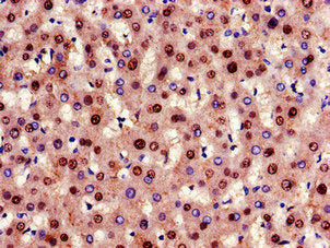 Immunohistochemistry of paraffin-embedded human liver tissue using GCGR Antibody at dilution of 1:100Rabbit anti-Human GCGR Polyclonal Antibody