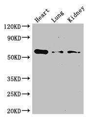 Western Blot | Positive WB detected in: Mouse heart tissue, Mouse lung tissue, Mouse kidney tissue | All lanes: Gcgr antibody at 3μg/ml | Secondary | Goat polyclonal to rabbit IgG at 1/50000 dilution | Predicted band size: 55 kDa | Observed band size: 55 kDaRabbit anti-Human GCGR Polyclonal Antibody