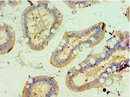 Immunohistochemistry of paraffin-embedded human small intestine tissue using GCK Antibody at dilution of 1:100Rabbit anti-Human GCK Polyclonal Antibody