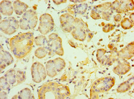 Immunohistochemistry of paraffin-embedded human pancreatic tissue using GCK Antibody at dilution of 1:100Rabbit anti-Human GCK Polyclonal Antibody