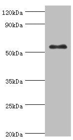 Western blot | All lanes: Glucokinase antibody at 8μg/ml + HepG2 whole cell lysate | Secondary | Goat polyclonal to rabbit IgG at 1/10000 dilution | Predicted band size: 52 kDa | Observed band size: 52 kDaRabbit anti-Human GCK Polyclonal Antibody