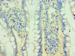 Immunohistochemistry of paraffin-embedded human small intestine tissue using GCK Antibody at dilution of 1:100Rabbit anti-Human GCK Polyclonal Antibody