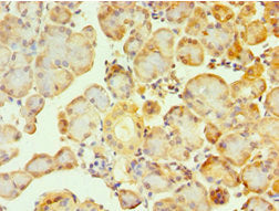 Immunohistochemistry of paraffin-embedded human pancreatic tissue using GCK Antibody at dilution of 1:100Rabbit anti-Human GCK Polyclonal Antibody