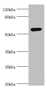 Western blot | All lanes: Glucokinase antibody at 8μg/ml + Jurkat whole cell lysate | Secondary | Goat polyclonal to rabbit IgG at 1/10000 dilution | Predicted band size: 52 kDa | Observed band size: 52 kDaRabbit anti-Human GCK Polyclonal Antibody