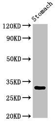 Western Blot | Positive WB detected in: Rat stomach tissue | All lanes: GCLM antibody at 3μg/ml | Secondary | Goat polyclonal to rabbit IgG at 1/50000 dilution | Predicted band size: 31, 29 kDa | Observed band size: 31 kDaRabbit anti-Human GCLM Polyclonal Antibody