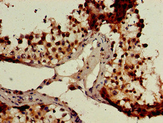 Immunohistochemistry of paraffin-embedded human testis tissue using GCM2 Antibody at dilution of 1:100Rabbit anti-Human GCM2 Polyclonal Antibody