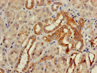 Immunohistochemistry of paraffin-embedded human kidney tissue using GCM2 Antibody at dilution of 1:100Rabbit anti-Human GCM2 Polyclonal Antibody