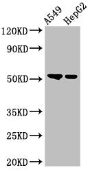 Western Blot | Positive WB detected in: A549 whole cell lysate, HepG2 whole cell lysate | All lanes: GCNT3 antibody at 3μg/ml | Secondary | Goat polyclonal to rabbit IgG at 1/50000 dilution | Predicted band size: 51 kDa | Observed band size: 51 kDaRabbit anti-Human GCNT3 Polyclonal Antibody
