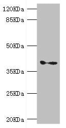 Western blot | All lanes: GDAP1 antibody at 1.11μg/ml + Mouse brain tissue | Secondary | Goat polyclonal to rabbit IgG at 1/10000 dilution | Predicted band size: 42, 34 kDa | Observed band size: 42 kDaRabbit anti-Human GDAP1 Polyclonal Antibody