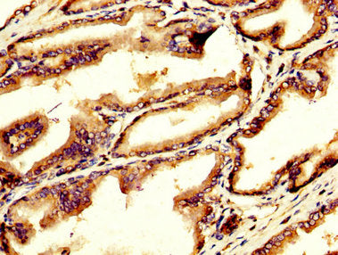 IHC image of GDF10 Antibody diluted at 1:200 and staining in paraffin-embedded human prostate tissue performed on a Leica BondTM system. After dewaxing and hydration, antigen retrieval was mediated by high pressure in a citrate buffer (pH 6.0). Section was blocked with 10% normal goat serum 30min at RT. Then primary antibody (1% BSA) was incubated at 4°C overnight. The primary is detected by a biotinylated secondary antibody and visualized using an HRP conjugated SP system.Rabbit anti-Human GDF10 Polyclonal Antibody