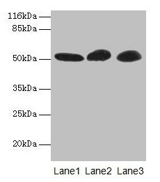 Western blot  | All lanes: GDI2 antibody at 2µg/ml  | Lane 1: Mouse brain tissue  | Lane 2: HepG2 whole cell lysate  | Lane 3: MCF-7 whole cell lysate  | Secondary  | Goat polyclonal to rabbit IgG at 1/10000 dilution  | Predicted band size: 51, 46 kDa  | Observed band size: 51 kDaRabbit anti-Human GDI2 Polyclonal Antibody