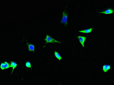 Immunofluorescent analysis of Hela cells using TSTA3 Antibody at dilution of 1:100 and Alexa Fluor 488-congugated AffiniPure Goat Anti-Rabbit IgG(H+L)Rabbit anti-Human TSTA3 Polyclonal Antibody