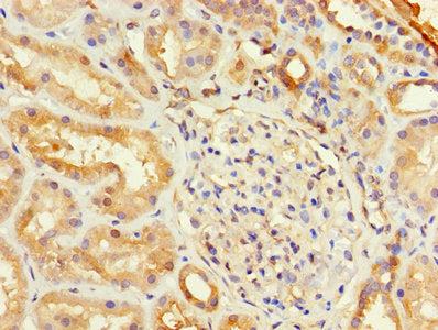 Immunohistochemistry of paraffin-embedded human kidney tissue using TSTA3 Antibody at dilution of 1:100Rabbit anti-Human TSTA3 Polyclonal Antibody