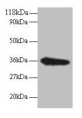 Western blot  | All lanes: TSTA3 antibody at 2µg/ml + EC109 whole cell lysate  | Secondary  | Goat polyclonal to rabbit IgG at 1/15000 dilution  | Predicted band size: 36 kDa  | Observed band size: 36 kDaRabbit anti-Human TSTA3 Polyclonal Antibody