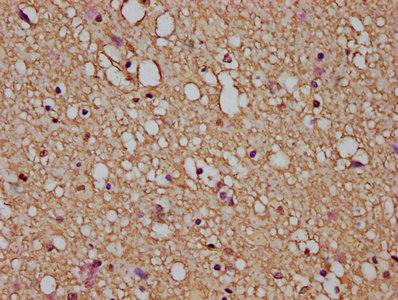 IHC image of GFAP Antibody diluted at 1:200 and staining in paraffin-embedded human brain tissue performed on a Leica BondTM system. After dewaxing and hydration, antigen retrieval was mediated by high pressure in a citrate buffer (pH 6.0). Section was blocked with 10% normal goat serum 30min at RT. Then primary antibody (1% BSA) was incubated at 4°C overnight. The primary is detected by a biotinylated secondary antibody and visualized using an HRP conjugated SP system.Rabbit anti-Human GFAP Polyclonal Antibody