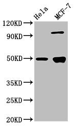 Western Blot  | Positive WB detected in: Hela whole cell lysate, MCF-7 whole cell lysate  | All lanes: GFAP antibody at 3.9µg/ml  | Secondary  | Goat polyclonal to rabbit IgG at 1/50000 dilution  | Predicted band size: 50, 51 kDa  | Observed band size: 50 kDaRabbit anti-Human GFAP Polyclonal Antibody