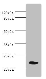 Western blot | All lanes: GFER antibody at 3μg/ml + Mouse liver tissue | Secondary | Goat polyclonal to rabbit IgG at 1/10000 dilution | Predicted band size: 24, 16 kDa | Observed band size: 24 kDaRabbit anti-Human GFER Polyclonal Antibody