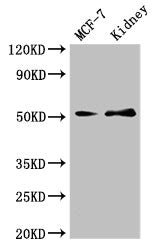 Western Blot  | Positive WB detected in: MCF-7 whole cell lysate, Mouse kidney tissue  | All lanes: GFRA1 antibody at 3µg/ml  | Secondary  | Goat polyclonal to rabbit IgG at 1/50000 dilution  | Predicted band size: 52, 51 kDa  | Observed band size: 52 kDaRabbit anti-Human GFRA1 Polyclonal Antibody