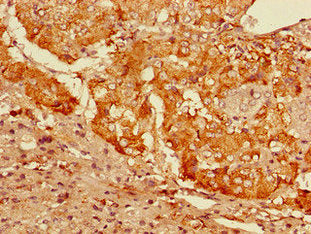 Immunohistochemistry of paraffin-embedded human adrenal gland tissue using the antibody at dilution of 1:100Rabbit anti-Human GFRA3 Polyclonal Antibody