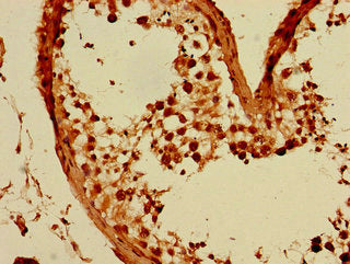 Immunohistochemistry of paraffin-embedded human testis tissue using GFRA3 Antibody at dilution of 1:100Rabbit anti-Human GFRA3 Polyclonal Antibody