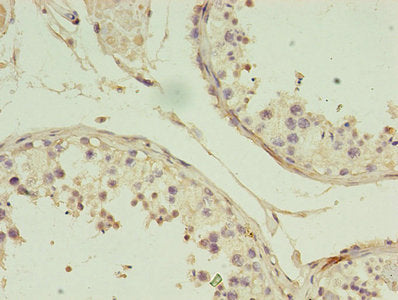 Immunohistochemistry of paraffin-embedded human testis tissue using CBLIF Antibody at dilution of 1:100