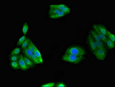 Immunofluorescent analysis of HepG2 cells using GIPC1 Antibody at dilution of 1:100 and Alexa Fluor 488-congugated AffiniPure Goat Anti-Rabbit IgG(H+L)Rabbit anti-Human GIPC1 Polyclonal Antibody
