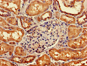 Immunohistochemistry of paraffin-embedded human kidney tissue using the antibody at dilution of 1:100Rabbit anti-Human GIPC1 Polyclonal Antibody