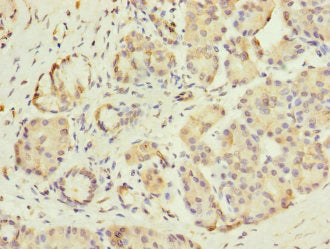Immunohistochemistry of paraffin-embedded human pancreatic tissue using GIPR Antibody at dilution of 1:100Rabbit anti-Human GIPR Polyclonal Antibody