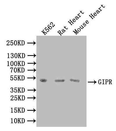 Western blot | All lanes: GIPR antibody at 5.89μg/ml | Lane 1: Rat heart tissue | Lane 2: Mouse brain tissue | Lane 3: Hela whole cell lysate | Lane 4: A549 whole cell lysate | Lane 5: HL60 whole cell lysate | Secondary | Goat polyclonal to rabbit IgG at 1/10000 dilution | Predicted band size: 54, 49, 50 kDa | Observed band size: 54 kDaRabbit anti-Human GIPR Polyclonal Antibody
