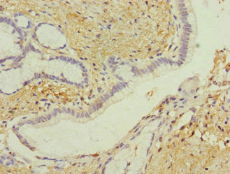 Immunohistochemistry of paraffin-embedded human pancreatic tissue using GIPR Antibody at dilution of 1:100Rabbit anti-Human GIPR Polyclonal Antibody