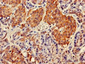 Immunohistochemistry of paraffin-embedded human pancreatic tissue using GIT1 Antibody at dilution of 1:100Rabbit anti-Human GIT1 Polyclonal Antibody