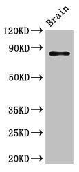 Western Blot | Positive WB detected in: Mouse brain tissue | All lanes: GIT1 antibody at 3.5μg/ml | Secondary | Goat polyclonal to rabbit IgG at 1/50000 dilution | Predicted band size: 85, 20, 86 kDa | Observed band size: 85 kDaRabbit anti-Human GIT1 Polyclonal Antibody