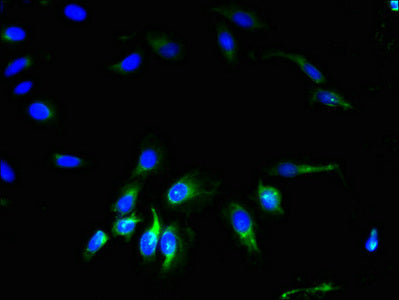 Immunofluorescent analysis of Hela cells using GJA4 Antibody at dilution of 1:100 and Alexa Fluor 488-congugated AffiniPure Goat Anti-Rabbit IgG(H+L)Rabbit anti-Human GJA4 Polyclonal Antibody