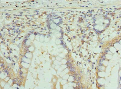 Immunohistochemistry of paraffin-embedded human small intestine tissue using the antibody at dilution of 1:100Rabbit anti-Human GJA4 Polyclonal Antibody