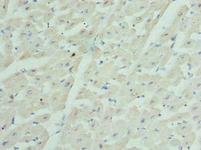 Immunohistochemistry of paraffin-embedded human heart tissue using GJA4 Antibody at dilution of 1:100Rabbit anti-Human GJA4 Polyclonal Antibody