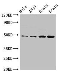 Western Blot | Positive WB detected in: Hela whole cell lysate, A549 whole cell lysate, Rat brain tissue, Mouse brain tissue | All lanes: GJA8 antibody at 2.5μg/ml | Secondary | Goat polyclonal to rabbit IgG at 1/50000 dilution | Predicted band size: 49 kDa | Observed band size: 49 kDaRabbit anti-Human GJA8 Polyclonal Antibody