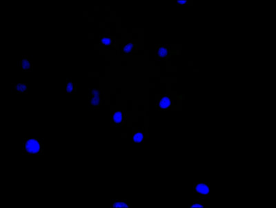 Immunofluorescence staining of Hela cell with 5% goat serum, counter-stained with DAPI. The cells were fixed in 4% formaldehyde and blocked in 10% normal Goat Serum. The cells were then incubated with the antibody overnight at 4C. The secondary antibody was Alexa Fluor 488-congugated AffiniPure Goat Anti-Rabbit IgG(H+L).Rabbit anti-Human GJB3 Polyclonal Antibody