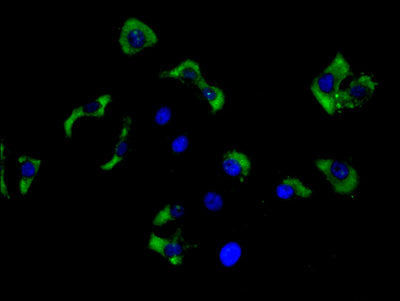 Immunofluorescence staining of Hela cell with GJB3 Antibody at 1:30, counter-stained with DAPI. The cells were fixed in 4% formaldehyde and blocked in 10% normal Goat Serum. The cells were then incubated with the antibody overnight at 4C. The secondary antibody was Alexa Fluor 488-congugated AffiniPure Goat Anti-Rabbit IgG(H+L).Rabbit anti-Human GJB3 Polyclonal Antibody