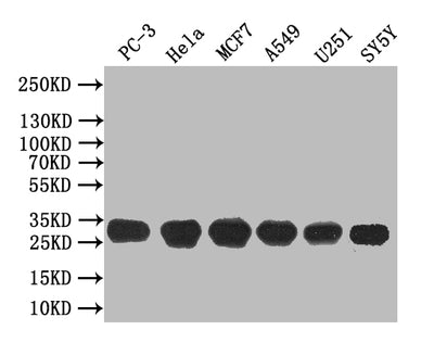 Western Blot Positive WB detected in: PC-3 whole cell lysate, Hela whole cell lysate, MCF7 whole cell lysate, A549 whole cell lysate, U251 whole cell lysate, SY5Y whole cell lysate All lanes: GJB3 antibody at 1:1000 Secondary Goat polyclonal to rabbit IgG at 1/50000 dilution Predicted band size: 30 kDa Observed band size: 30 kDaRabbit anti-Human GJB3 Polyclonal Antibody