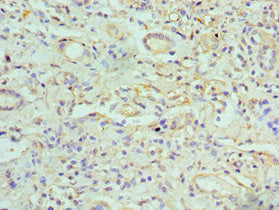 Immunohistochemistry of paraffin-embedded human kidney tissue using GJC1 Antibody at dilution of 1:100Rabbit anti-Human GJC1 Polyclonal Antibody