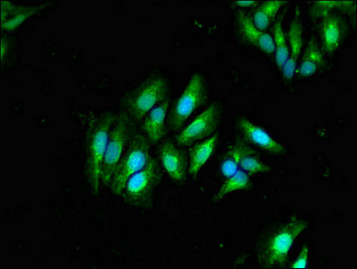 Immunofluorescent analysis of Hela cells using GLB1 Antibody at dilution of 1:100 and Alexa Fluor 488-congugated AffiniPure Goat Anti-Rabbit IgG(H+L)Rabbit anti-Human GLB1 Polyclonal Antibody