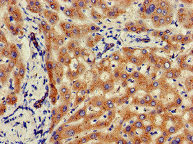 Immunohistochemistry of paraffin-embedded human liver tissue using GLB1 Antibody at dilution of 1:100Rabbit anti-Human GLB1 Polyclonal Antibody