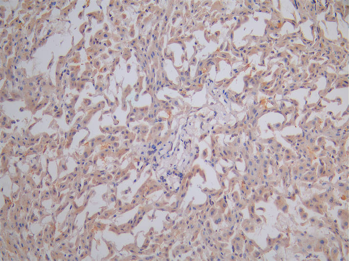 IHC image of APOE Antibody diluted at 1:100 and staining in paraffin-embedded human liver tissue performed on a Leica BondTM system. After dewaxing and hydration, antigen retrieval was mediated by high pressure in a citrate buffer (pH 6.0). Section was blocked with 10% normal goat serum 30min at RT. Then primary antibody (1% BSA) was incubated at 4°C overnight. The primary is detected by a Goat anti-rabbit polymer IgG labeled by HRP and visualized using 0.05% DAB.Rabbit anti-Human APOE Polyclonal Antibody